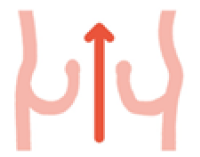 正常な弁が開いている時のイメージ