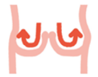 正常な弁が閉じている時のイメージ