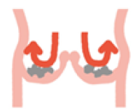 狭窄症の弁が閉じている時のイメージ