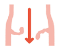 閉鎖不全症の弁が閉じている時のイメージ